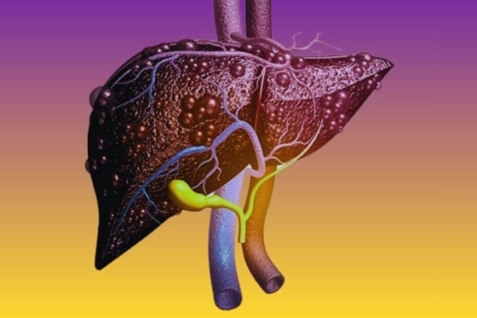 Cómo evitar la hepatitis tóxica. Estos son los alimentos, hierbas y suplementos que son peligrosos para este órgano vital