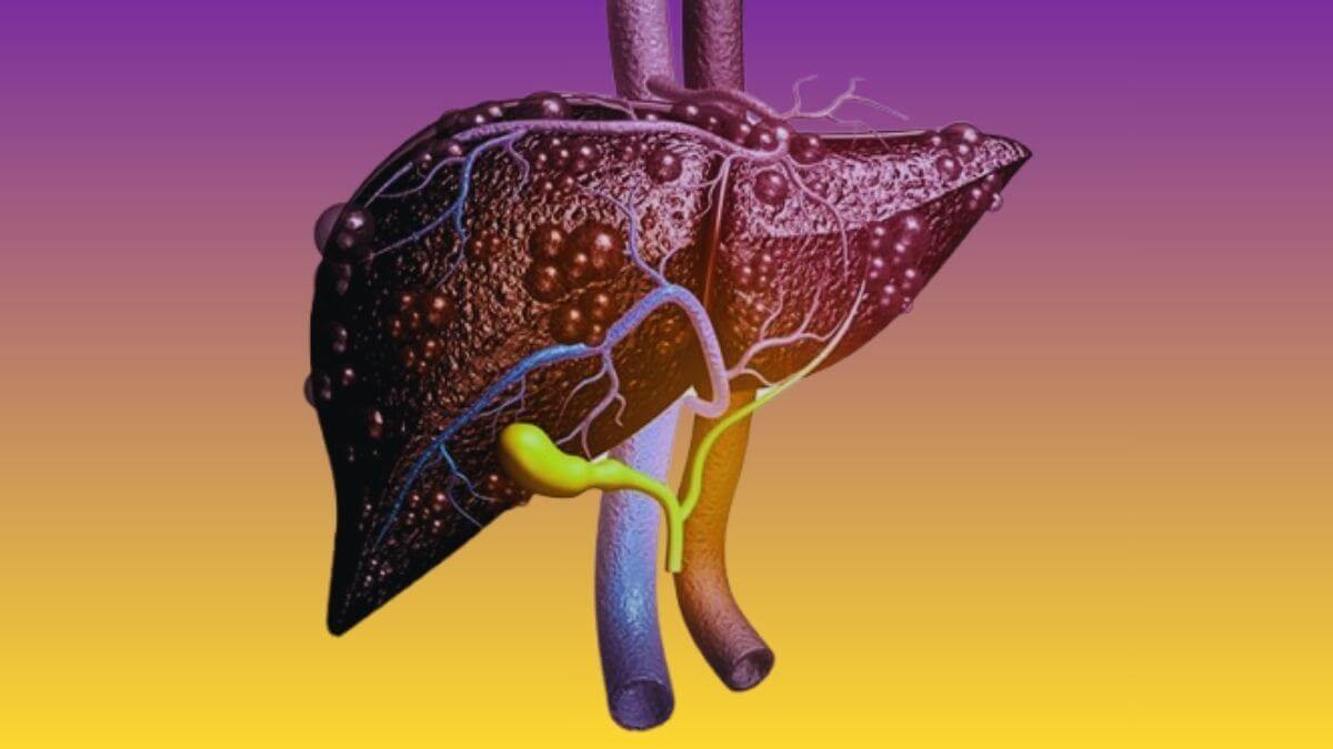 Cómo evitar la hepatitis tóxica. Estos son los alimentos, hierbas y suplementos que son peligrosos para este órgano vital